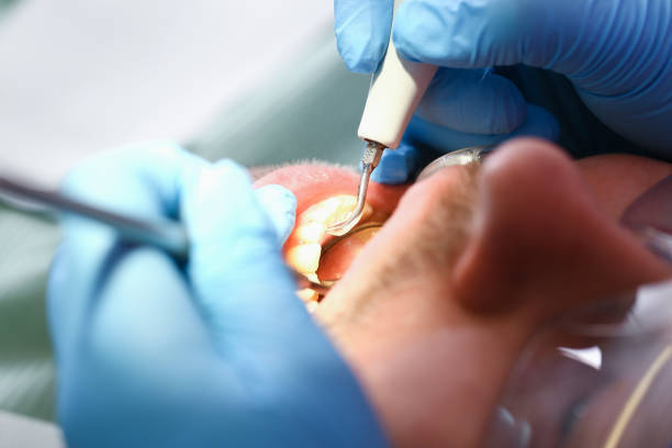 Best Root Canal Emergency Dentist  in Silverton, OH