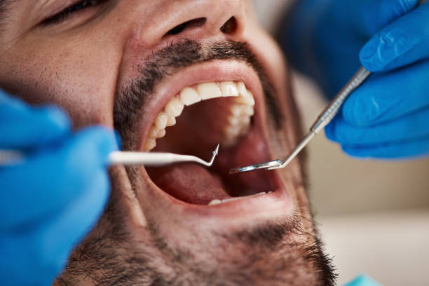 Best Tooth Infection Emergency Dentist  in Silverton, OH